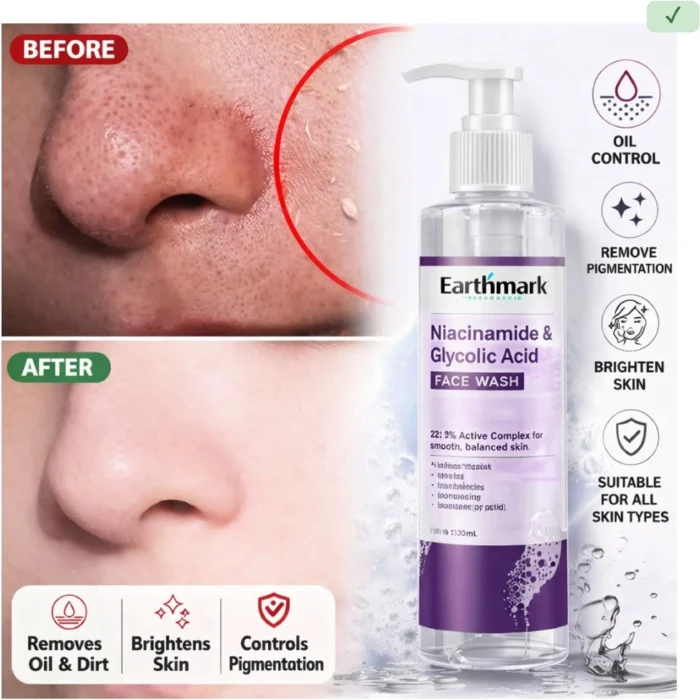 100-facewash-for-men-fights-acne-pimple-clear-pores-brightening-original-imahztfdkv8steuz.jpeg 100-facewash-for-men-fights-acne-pimple-clear-pores-brightening-original-imahztfdkv8steuz.jpeg